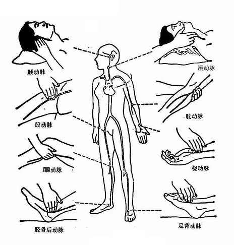 絲脈|護理學/異常脈搏的觀察及護理